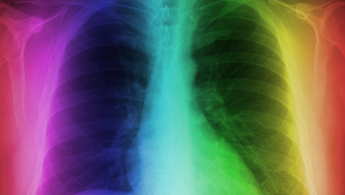 x-ray